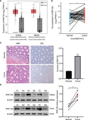 Ring finger protein 128 promotes, rather than inhibits, colorectal cancer progression by regulating the Hippo signaling pathway